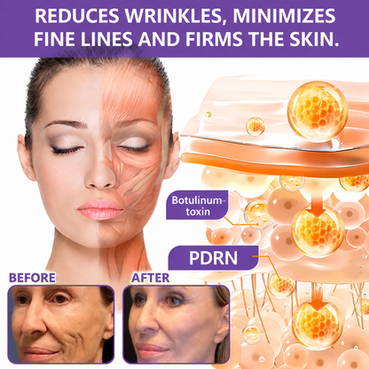 TopSpire®🎗️ PDRN Multi-Peptide Massage Roller Cream – Anti-Aging, Hydrating, Firming & Lifting Care for Smoother, More Radiant-Looking Skin