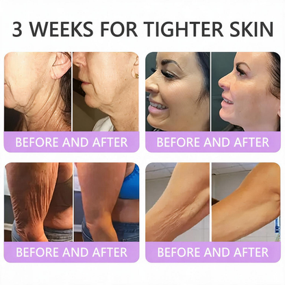 TopSpire®🎗️ PDRN Multi-Peptide Massage Roller Cream – Anti-Aging, Hydrating, Firming & Lifting Care for Smoother, More Radiant-Looking Skin
